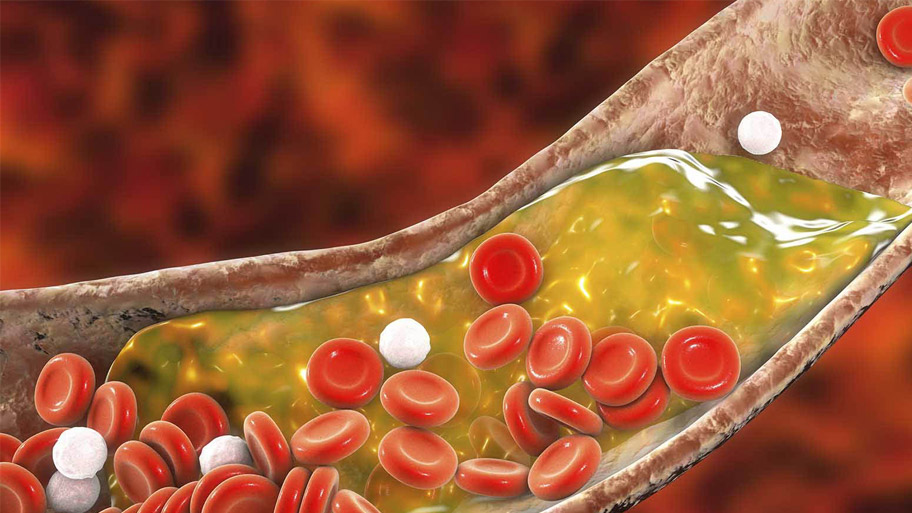 Chocolate có khả năng giảm cholesterol hiệu quả